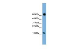Suppressor of Ty 4 homolog 1 Antibody, Novus Biologicals 100 &mu;L | Buy Online | Novus Biologicals | Fisher Scientific